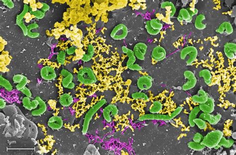 Read Biohydrometallurgy 