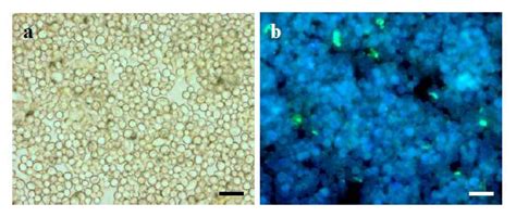 Biomass Wall Spore