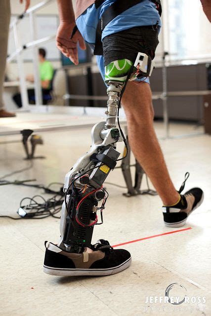 Biomedical Engineering Prosthetic Limbs