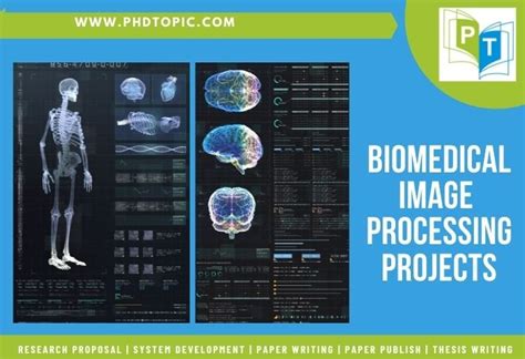 Biomedical Image Processing Projects With Matlab Code