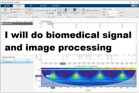Full Download Biomedical Signal And Image Processing 
