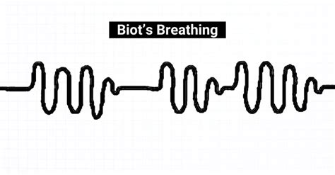 Biot Respirations