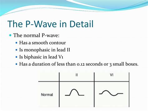 Biphasic P Wave