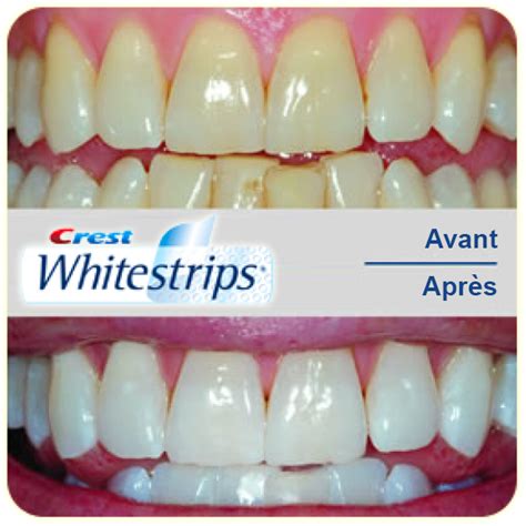Blanchiment Dentaire 3d   Blanchiment Dentaire Rapide Crest 3d Whitestrips Professional Effects - Blanchiment Dentaire 3d