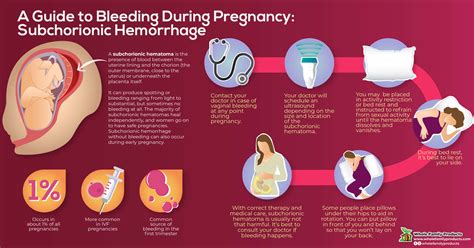 Bleeding During Pregnancy A Comprehensive Guide