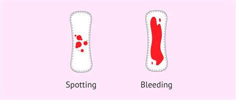 bleeding while pregnant is it normal
