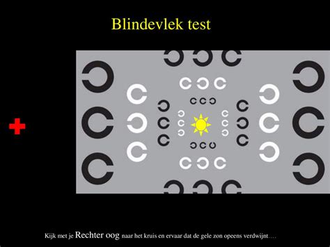blinde vlek gezichtsveld