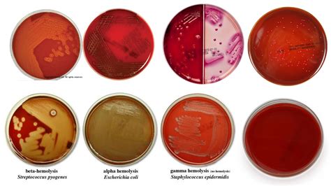 blood agar bacteria