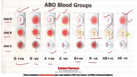 Read Online Blood Group Questions And Answers Pdf Download 
