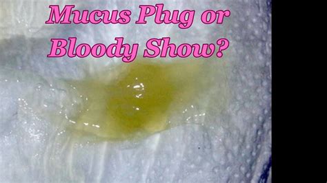 bloody mucus show