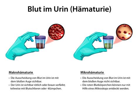 blut und boser mann