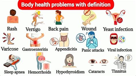 body image problems and body dysmorphic disorder
