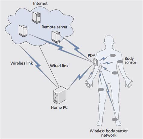 Body Sensor Networks