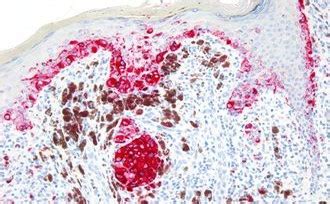 Bond Polymer Refine Red Detection Leica Biosystems