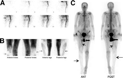 Bone And Joint Imaging