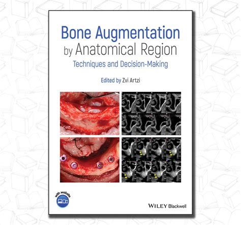 Bone Augmentation Techniques Journal Of Periodontology
