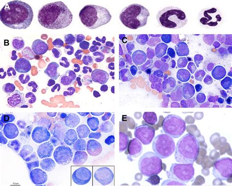 Bone Marrow Evaluation In Veterinary Practice