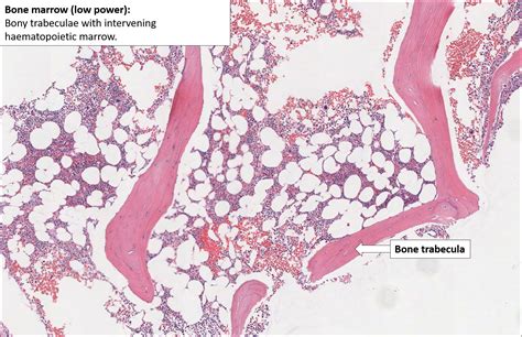 Bone Marrow Pathology