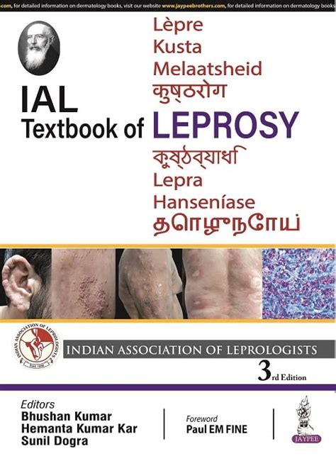 Books About Leprosy Novel Flavor Fantasy Novel Leprosy - Fantasy Novel Leprosy