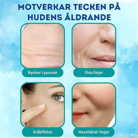 botox sundsvall pris