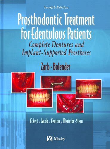 Download Bouchers Prosthodontic Treatment For Edentulous Patients 