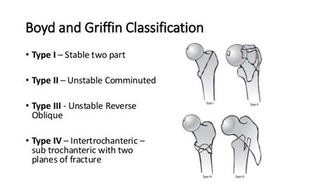 Boyd And Griffin Classification
