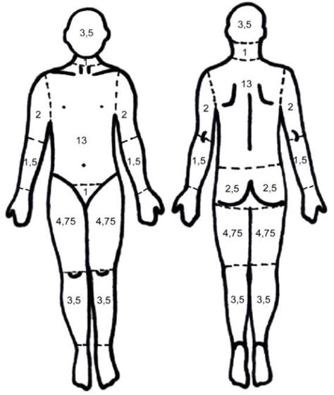 brännskada barn procent