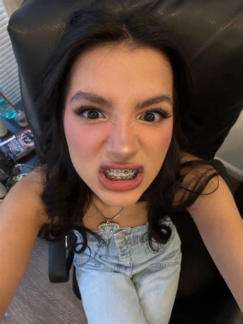 braces nude