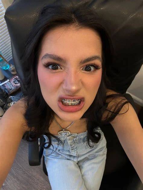 braces nude selfie