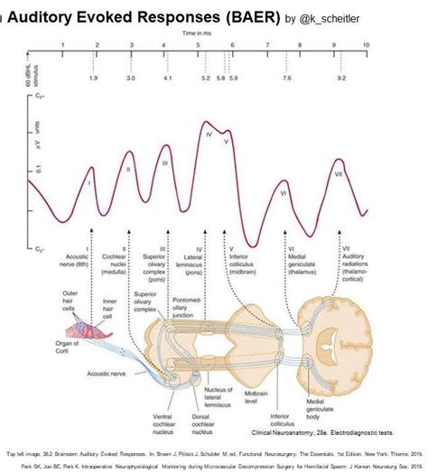 Brainstem Evoked Response Audiometry