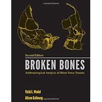 Read Broken Bones Anthropological Analysis Of Blunt Force Trauma 2Nd Edition 