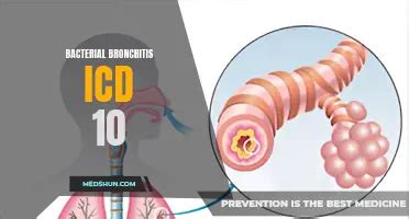 Bronchospasm Icd 10