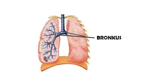 bronkus adalah