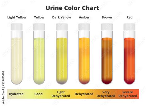 brown colored urine
