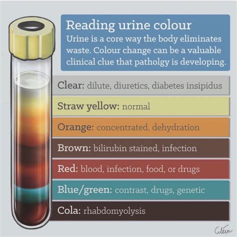 brown flecks in urine
