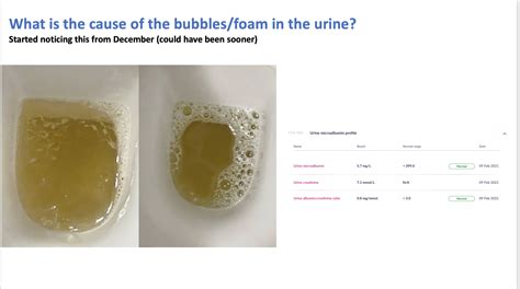 bubbles in my pee