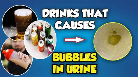bubbles in urine after drinking alcohol