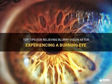 Burning Vision