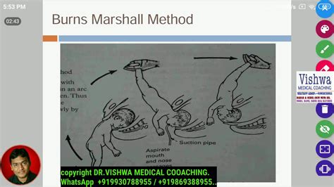 Burns Marshall Method