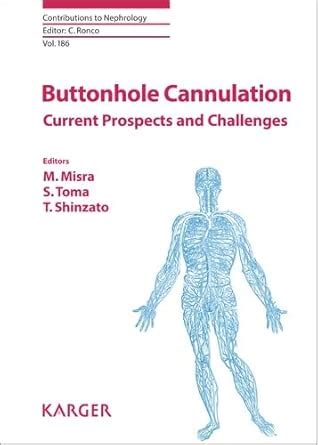 Buttonhole Cannulation Current Prospects And Challenges Contributions To Nephrology Vol 186