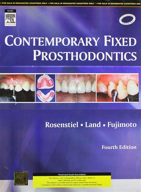 Read By Stephen F Rosenstiel Contemporary Fixed Prosthodontics 4Th Fourth Edition 