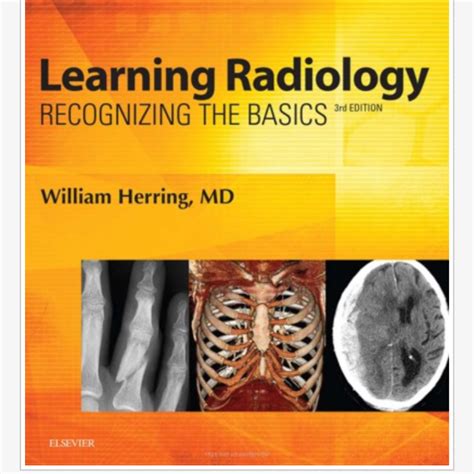 Download By William Herring Learning Radiology Recognizing The Basics With Student Consult Online Access 2Nd Second Edition 