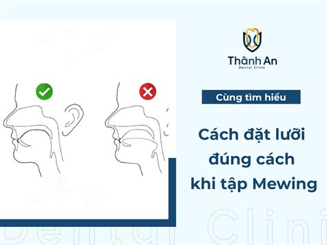 cách mewing | Hng dn cch tp Mewing ng cho