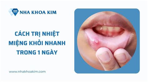 cách trị nhiệt miệng trong 1 ngày | Cch tr nhit ming trong 1 ngy