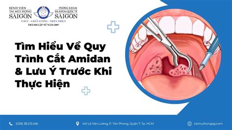 cắt amidan | Cc phng php v quy trnh ct
