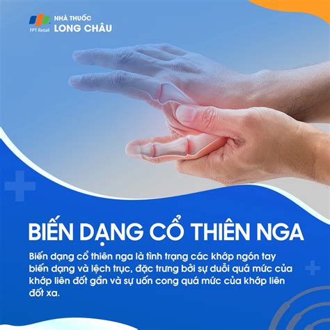 cổ thiên nga | Bin dng c thin nga nh ngha