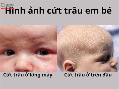 cứt trâu | Ct Tru L G V N Ko