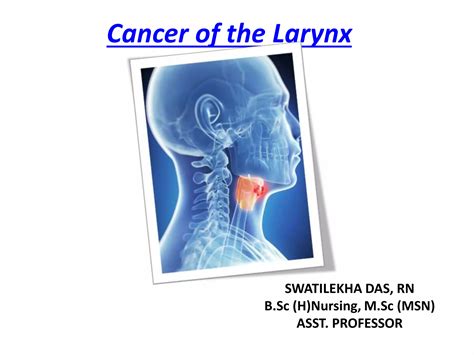 Ca Larynx Ppt
