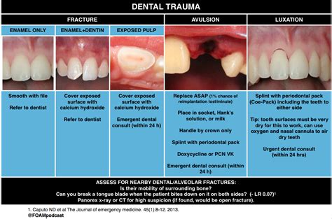 can braces cause tooth trauma icd 10