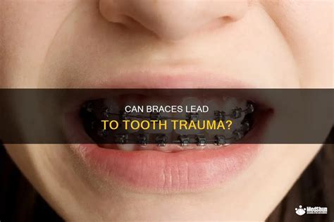 can braces cause tooth trauma